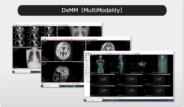 Dicomビューワ(DxMM)