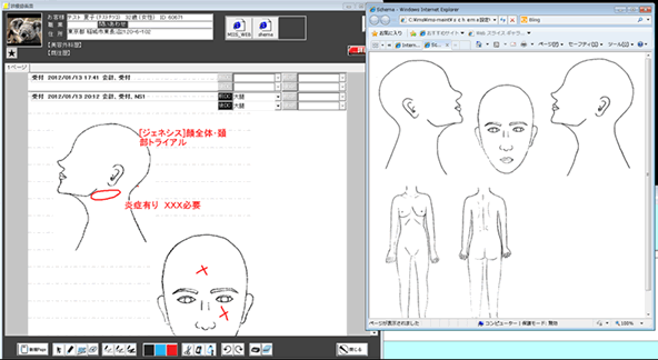 手書きベースの電子カルテ画面