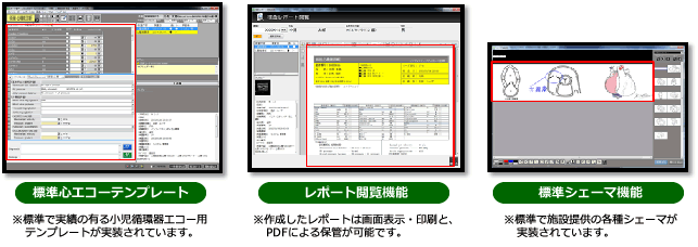 小児心エコー専用レポートソフトウェアイメージ図